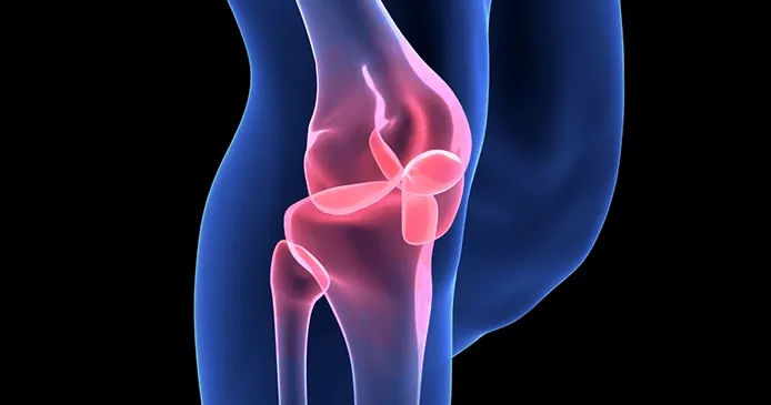 Losing weight can reduce knee pain and improve the kinematic function of the knee. It is estimated that nearly one-third of adults with obesity have arthritis.